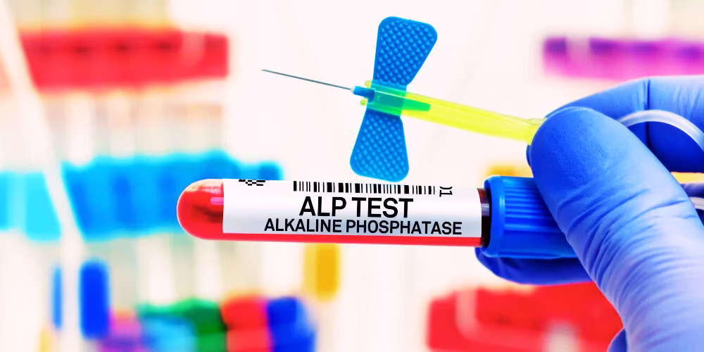alkaline-phosphatase (alp)
