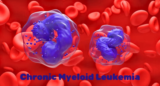 chronic-myeloid-leukemia