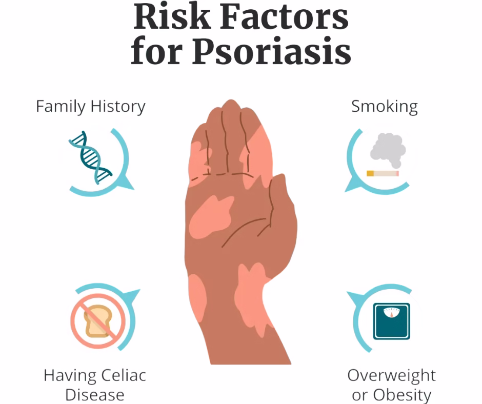 psoriasis-risk-factor